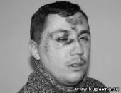 Старая Купавна - В подмосковном Ногинске избит местный депутат, который выступал за конкуренцию в сфере ЖКХ