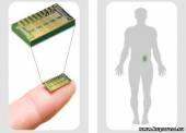 Старая Купавна - Специалисты MicroCHIPS успешно испытали на людях имплантируемый чип